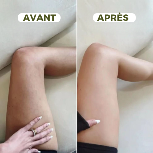 Ventouse Massante – Anti-Cellulite